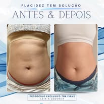 Antes e depois — flacidez corporal