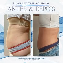 Antes e depois — protocolo corporal